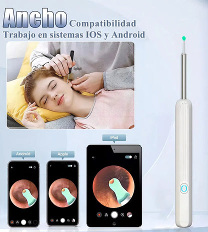 Limpiador de Oídos Inteligente - Limpieza segura y visible ✨
