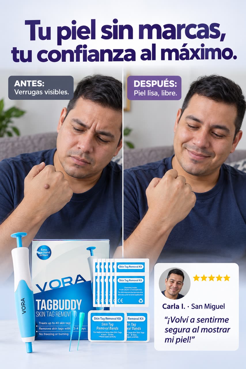 Kit TagBuddy – ¡Adiós a las verrugas! — T · LA TRANSFORMACIÓN
