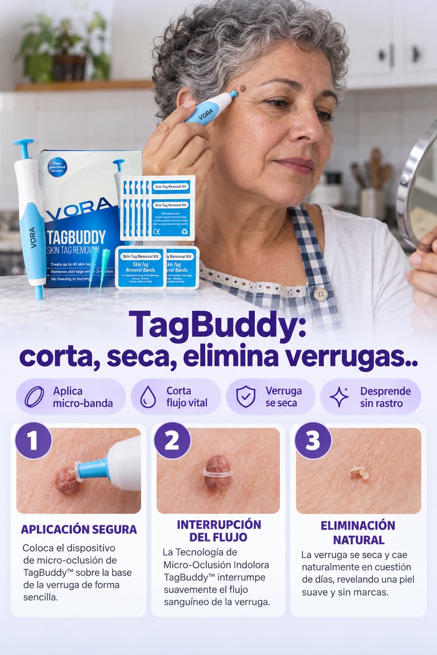 Kit TagBuddy – ¡Adiós a las verrugas! — I · EL MECANISMO FUNCIONANDO