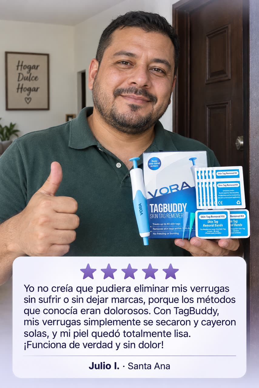 Kit TagBuddy – ¡Adiós a las verrugas! — D · LA RESEÑA QUE CONVENCE